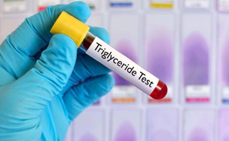 Cum puteți reduce trigliceridele în mod natural